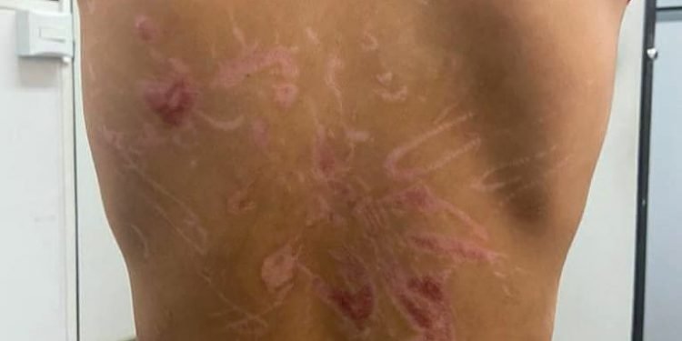 SUSPEITO DE TORTURAR FILHO COM AFOGAMENTO E ELETROCHOQUE DIZ QUE ERA AGREDIDO PELO PAI