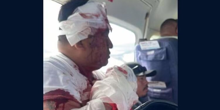 Homem sequestra avião em Belize e é morto a tiros por passageiro após o pouso, diz polícia